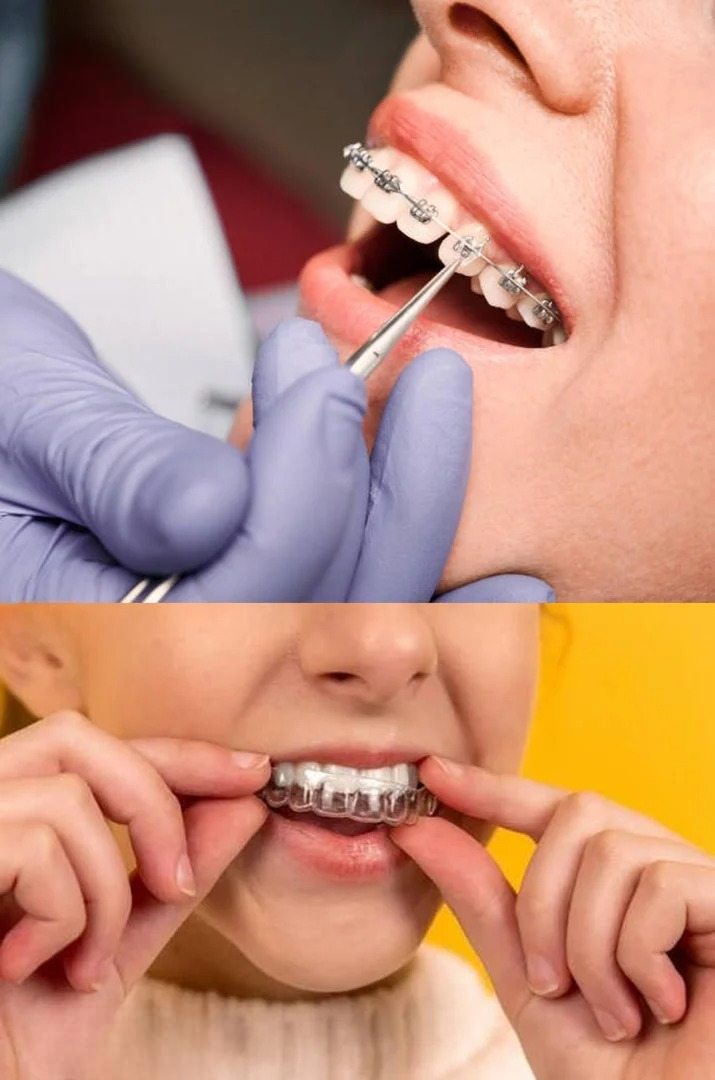 Orthodontics dental